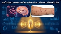 Chủ động phòng chống viêm màng não do não mô cầu