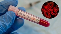 Tăng cường giám sát, kiểm soát nguy cơ dịch bệnh Ebola xâm nhập vào Việt Nam