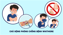 Chủ động phòng chống bệnh Whitmore