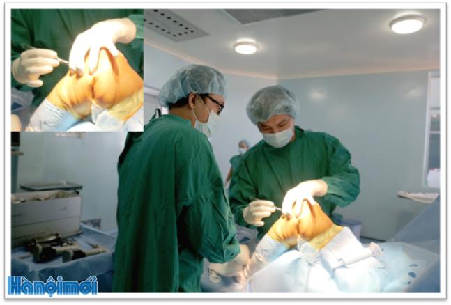 Bệnh viện huyện Củ Chi thay khớp gối thành công cho bệnh nhân