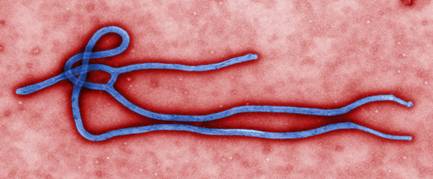 Những điều cần nhớ về bệnh do virut Ebola