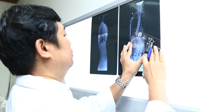 Bệnh viện Hữu nghị Việt Đức: khám và tư vấn miễn phí bệnh gù vẹo cột sống