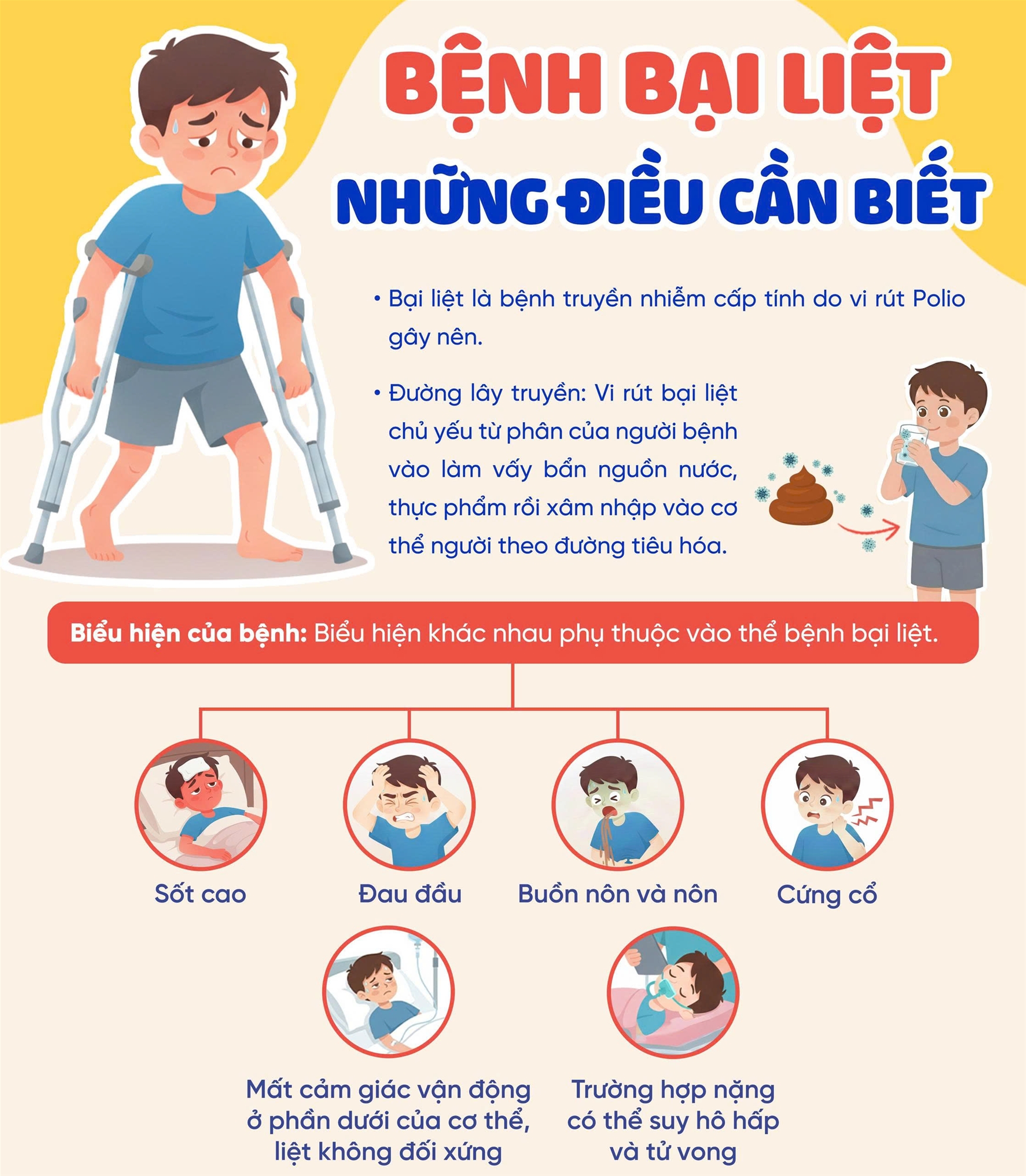 Bệnh bại liệt - Những điều cần biết